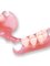 Magadh Oro Dental - Implant & Orthodontic Clinic - Flexible Denture 