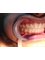 Magadh Oro Dental & Orthodontic Clinic - Invisalign / Invisible Braces 
