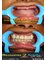 Reasons 2 Smile - full mouth dental implants 