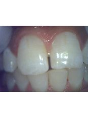 Dentist Consultation - Ar 32 Signature Smiles Executive Poly Dental Care