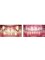 Dr. Kadu's Orthodontic And Dental Clinic - Before and After braces treatment 