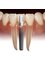 Dr. Kadu's Orthodontic And Dental Clinic - Dental Implant 