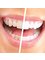 SYMA Dental Care Pvt. Ltd. - Teeth Whitening 