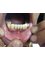 Aashvi Dental Care - after treatment (Fix teeth) 
