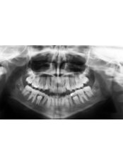 Panoramic Dental X-Ray - Rishi Multispeciality Dental Clinic