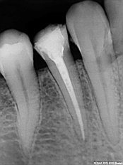 Digital Dental X-Ray - Rishi Multispeciality Dental Clinic
