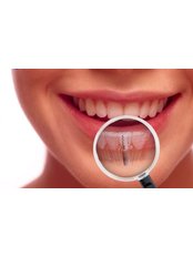 Dental Implants - Salem Dentist - Top Dental Clinic Salem