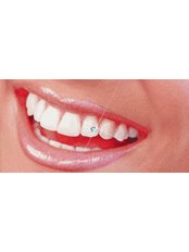 Tooth Jewellery - Dr.Parekh's Dental Care
