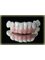 Muskan Dental Care and Implant center - AESTHETIC ZIRCONIA (METAL FREE) CROWNS 