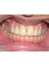 Cosmetic Dentist Consultation - 'Precious Smile' Dental Cosmetic & Implant Centre
