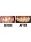 Raga Dental Center for Dental Implants & Laser - AESTHETIC REHABILITATION  