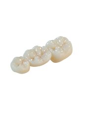 Dental Crowns - iSmile Orthodontic& Dental Care Clinic
