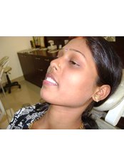 Orthodontist Consultation - Rudra Dental