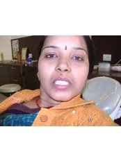 Dental Bridges - Rudra Dental