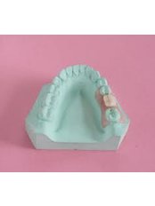 Immediate Dentures - Milda Dental Care Orthodontic Specialist