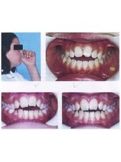 Orthodontist Consultation - Milda Dental Care Orthodontic Specialist