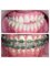 Milda Dental Care Orthodontic Specialist - Jl. Kalijati Raya No.28 Antapani, Bandung, West Java, 40291,  16