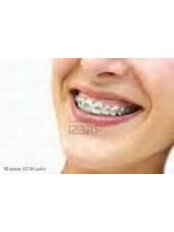 Metal Braces - Milda Dental Care Orthodontic Specialist