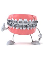 Metal Braces - Milda Dental Care Orthodontic Specialist