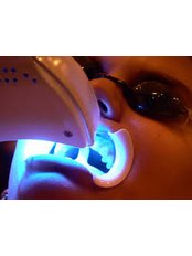 Laser Teeth Whitening - Milda Dental Care Orthodontic Specialist