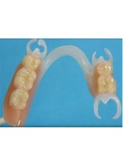 Flexible Partial Dentures - Milda Dental Care Orthodontic Specialist