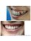 Milda Dental Care Orthodontic Specialist - Jl. Kalijati Raya No.28 Antapani, Bandung, West Java, 40291,  5