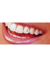 Tooth Jewellery - Escalade Dental Care Specialist