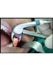 Extractions - Jakarta Dental Specialist