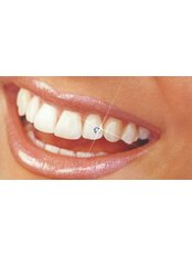 Tooth Jewellery - Jakarta Smile - Family Dental-Kenmanggisan