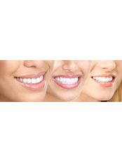 Cosmetic Dentist Consultation - Jakarta Smile - Family Dental-Plaza Atrium