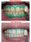 Linus Boekitwetan Dental Care Center - Whitening 