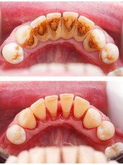 Hygienist Session - Natura Dentica Dental Studio