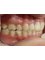Arafah Orthodontic Clinic - after treatment 