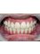 Arafah Orthodontic Clinic - after treatment 