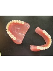 Acrylic Dentures - LaDenta Dental Clinic Branch of Hotel Aston
