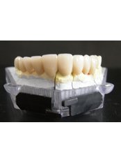 Dental Crowns - LaDenta Dental Clinic Branch of Hotel Aston