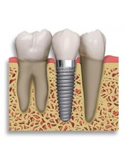 Dental Implants - LaDenta Dental Clinic Branch of Hotel Aston