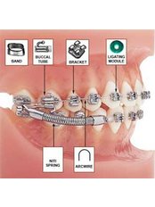 Orthodontist Consultation - LaDenta Dental Clinic Branch of Hotel Aston