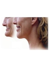 Mini Implants - LaDenta Dental Clinic Branch of Sei Besitang