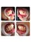 Smile Dental Clinic - Diastema Closure with composite resin 