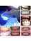 The Teeth Whitening Clinic Cork - At The Teeth Whitening Clinic our one hour laser teeth whitening treatment with eave your teeth 12-14 shades whiter with zero sensitivity 