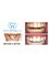 The Teeth Whitening Clinic Cork - Our before and afters show our results! With clinic 6 days a week and our city centre location we are Cork's best teeth whitening clinic 