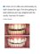 The Teeth Whitening Clinic Cork - Yellow stained teeth from too much coffee,wine or tobacco? Not a problem! Our laser teeth whitening treatment will leave you with a whiter,brighter smile. Our pictures speak for themselves! 