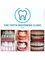The Teeth Whitening Clinic Cork - At the Teeth Whitening Clinic Cork our before and after pictures speak for themselves, amazing results and zero sensitivity 