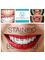 The Teeth Whitening Clinic Cork - Stained and yellow teeth, no problem at The Teeth Whitening Clinic, our one hour laser teeth whitening treatment results in whiter, brighter teeth 