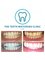 The Teeth Whitening Clinic Cork - Our results speak for themselves. Yellow teeth can be a thing of the past! Get your smile noticed and say bye bye to stained teeth. Zero sensitivity guaranteed and amazing results! 