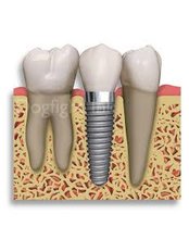 Implant Dentist Consultation - Hungarian Dental Clinic
