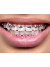 Orthodontist Consultation - Hungarian Dental Clinic