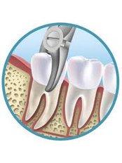 Oral and Maxillofacial Surgeon Consultation - Hungarian Dental Clinic