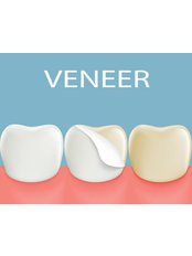 Veneers - Dental Artistry
